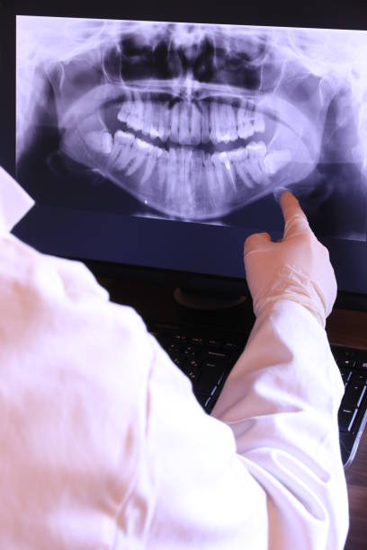 Best Emergency Wisdom Teeth Removal in Narberth, PA