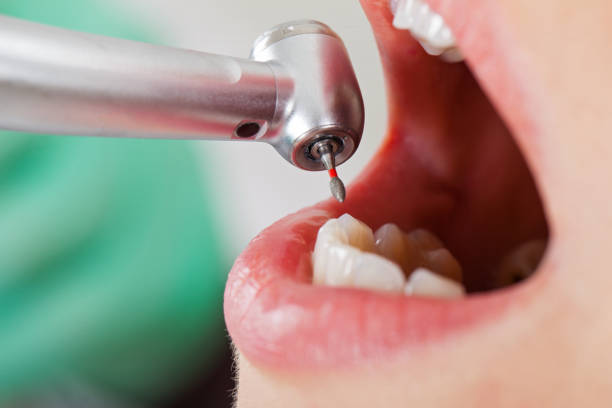 Best Emergency Treatment for Toothache in Narberth, PA